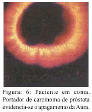Figura 6